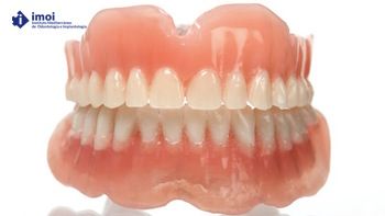DENTADURA SIN IMPLANTE