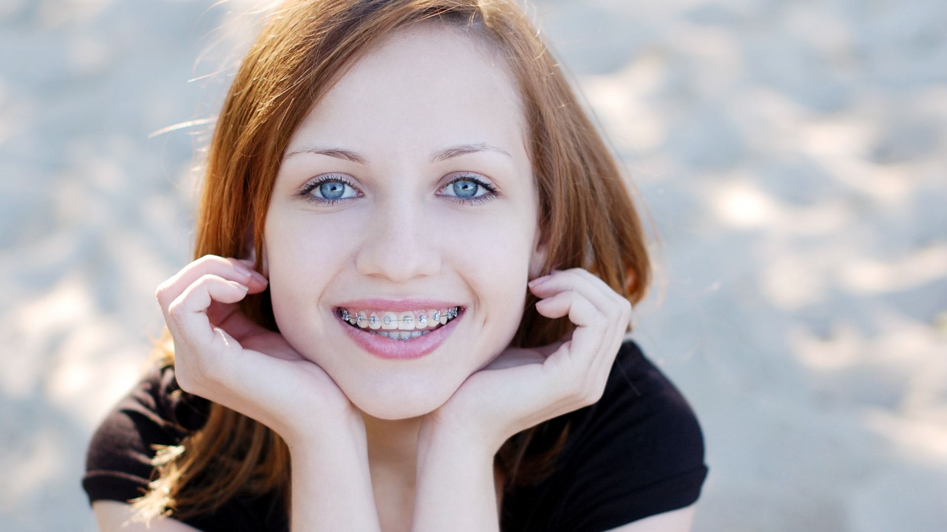 Tratamiento de Brackets Autoligables Clínica dental IMOI