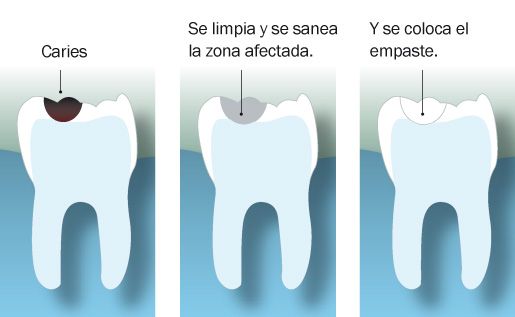 empaste-caries