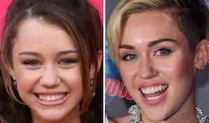 famosos i dents perfectes