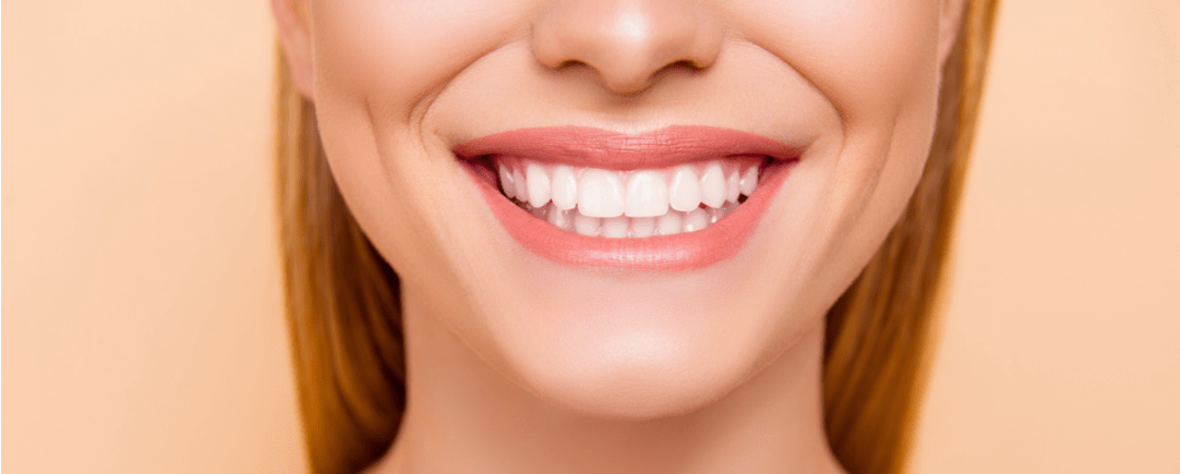 Coronas Y Fundas Sobre Implantes Dentales