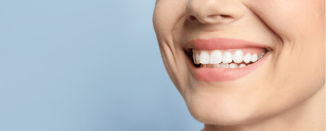 Informacion Implantes Dentales Imoi