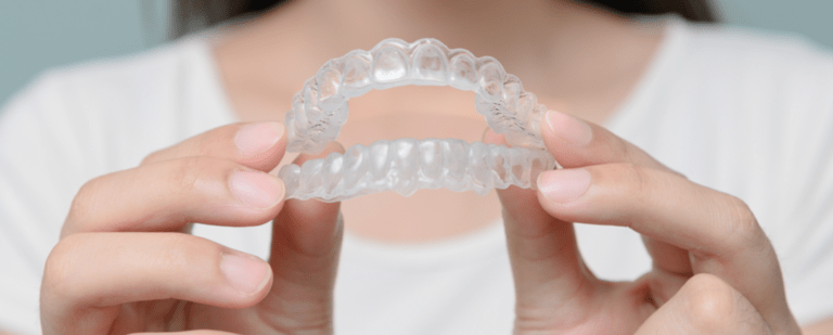 Invisalign alineadores