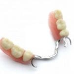protesi-dental-parcial