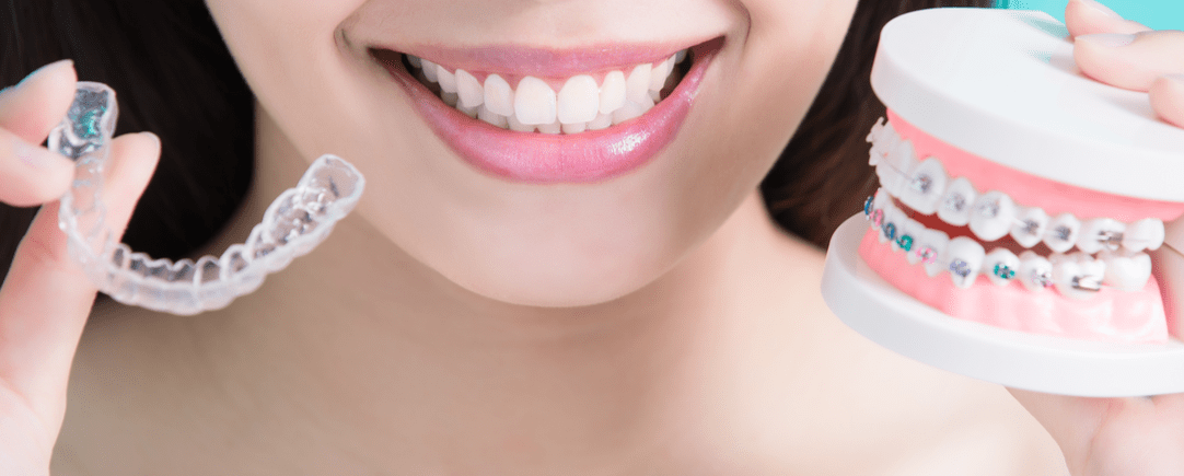 Que Ortodoncia Elijo