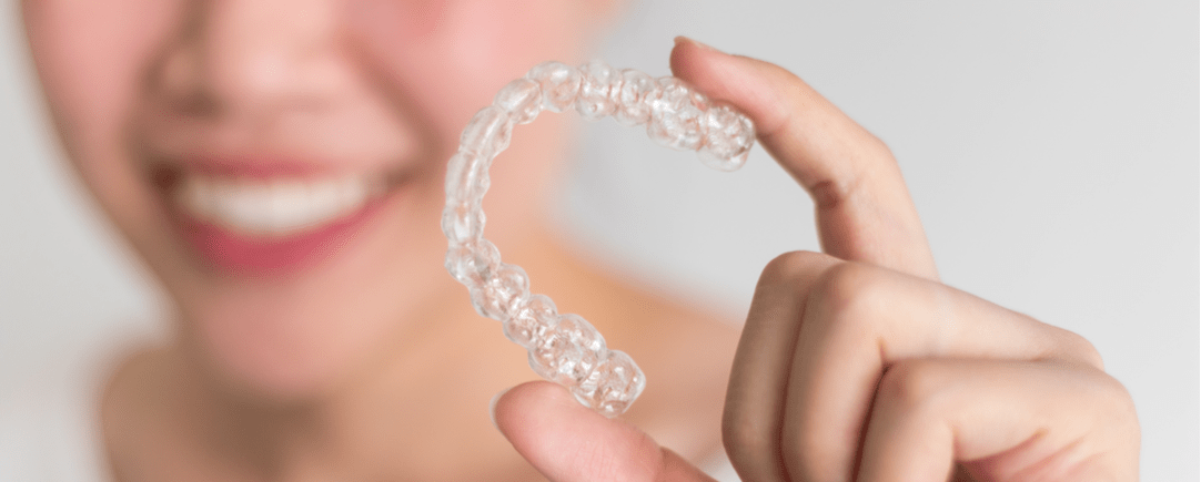 Ventajas Invisalign